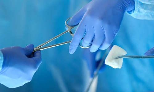 cắt bao quy đầu