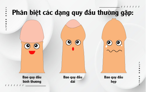 (Hình ảnh phân biết bao quy đầu)